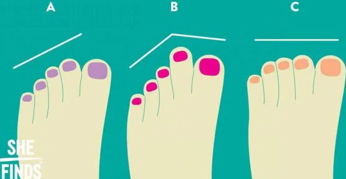 Каква форма са пръстите на краката ти? Ето какво казват за вашата личност 1
